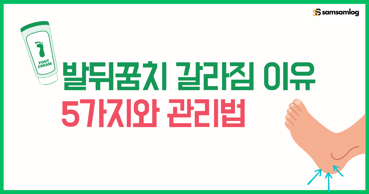 발뒤꿈치 갈라짐 이유 5가지와 효과적인 관리법 알아보기