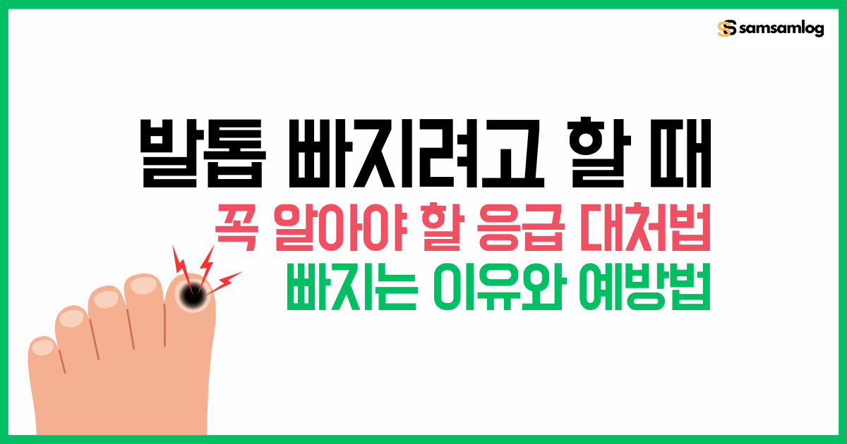 발톱 빠지려고 할 때 꼭 알아야 할 응급 대처법과 원인 및 예방법