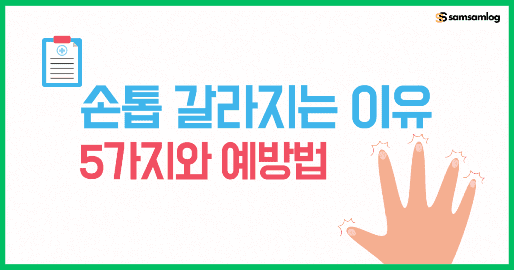 손톱 갈라지는 이유 5가지와 간단한 예방법 알아보기